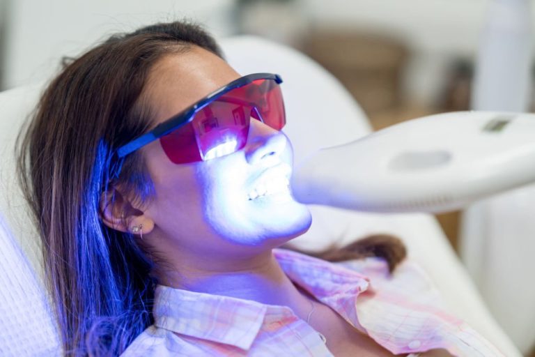 best teeth whitening toronto cost